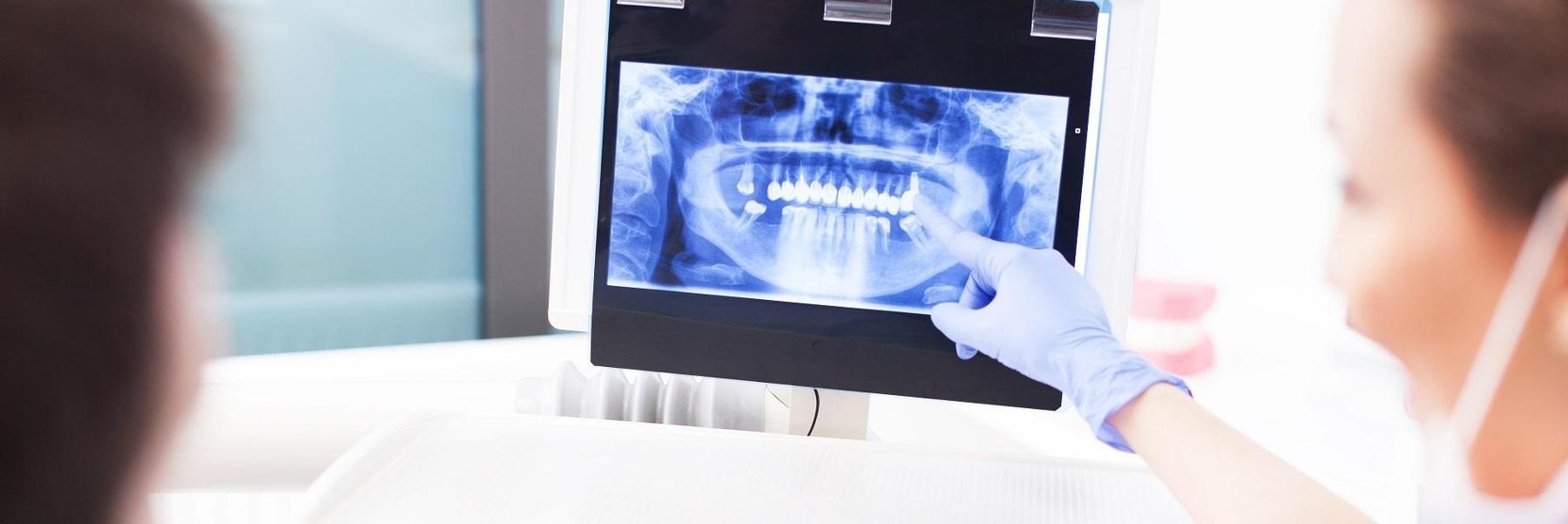 Surgical Orthodontic Treatment | Dentist